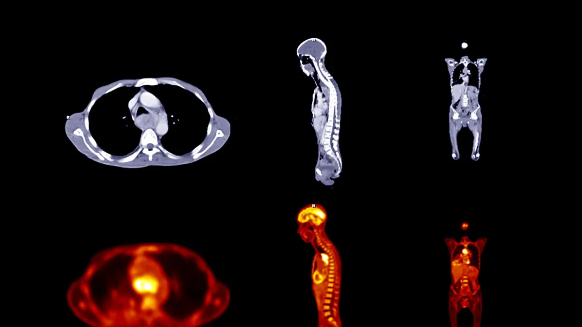 Anatomik düzlemler: tüm vücudun aksiyel, sagital ve koronal düzlemlerdeki BT kesitleri